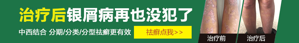 打造银屑病专科医院 让更多的患者